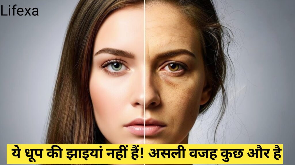 Hormonal pigmentation 2026