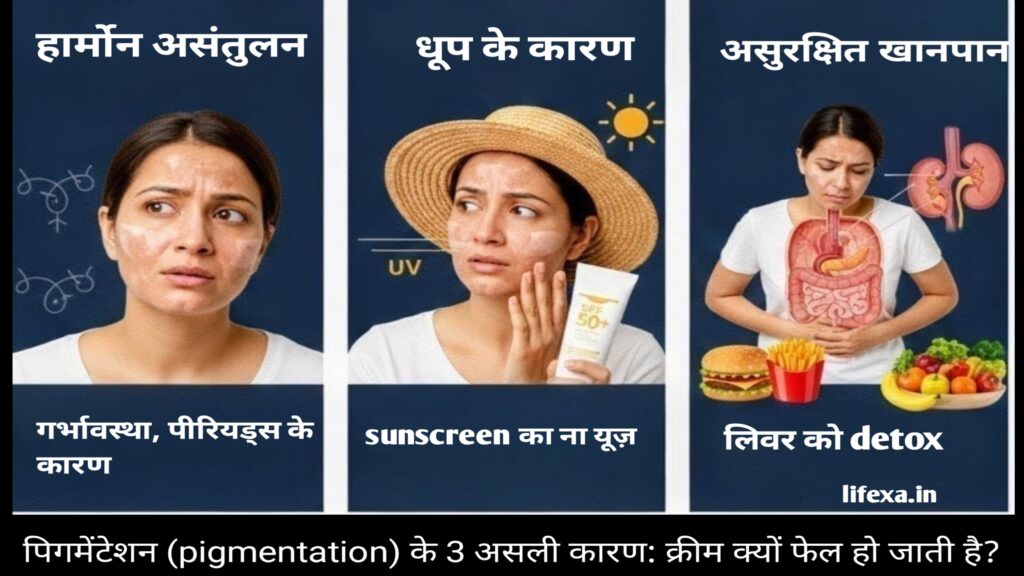 पिगमेंटेशन (Pigmentation) के मुख्य कारण और इलाज - Lifexa