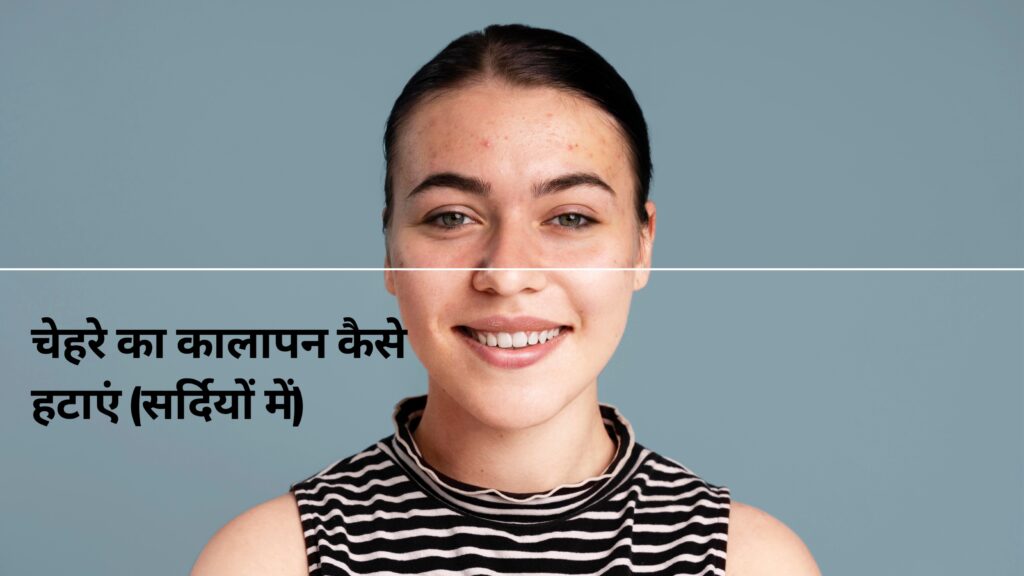 धूप से होने वाला कालापन